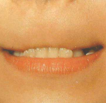 昆明医科大学附属口腔医院