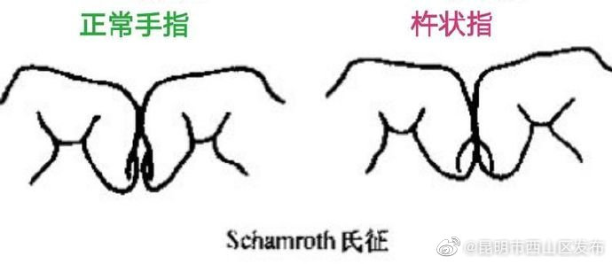 昆明市西山区发布