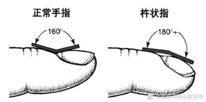 昆明市西山区发布