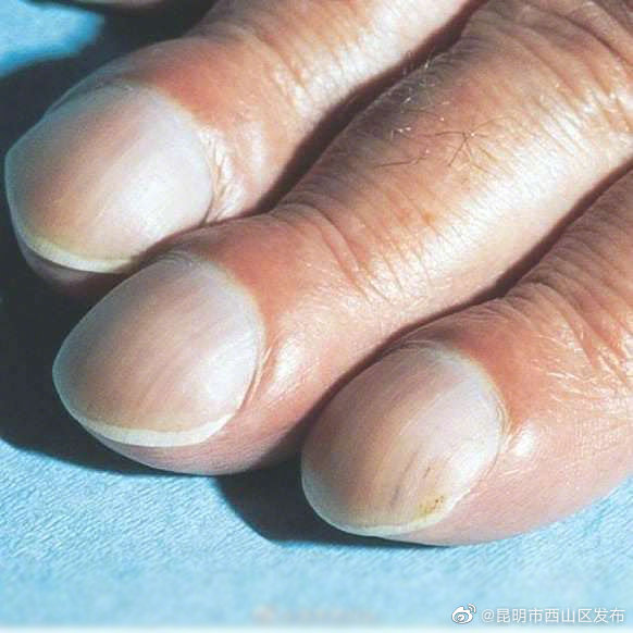 昆明市西山区发布