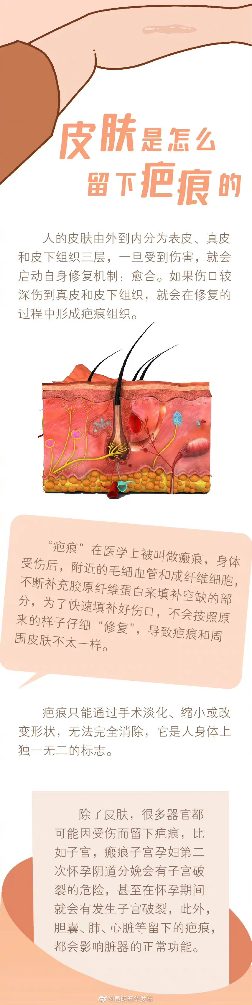 “昆明五华发布”微博