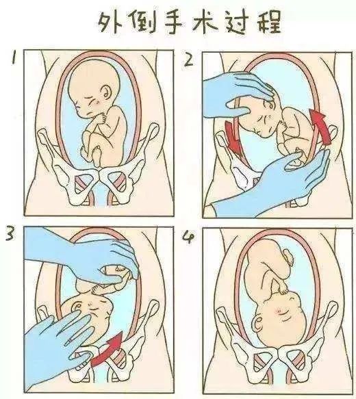 云南省第三人民医院