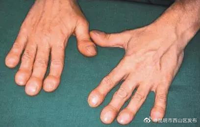 昆明市西山区发布