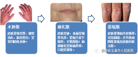 云南省玉溪市人民医院