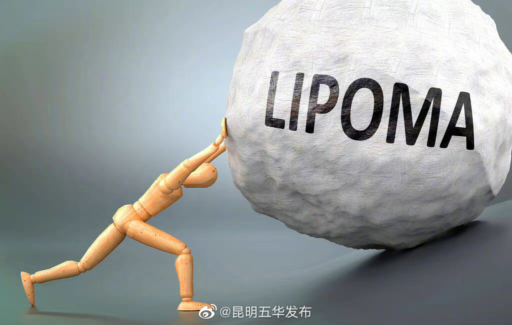 脂肪瘤有可能癌变吗