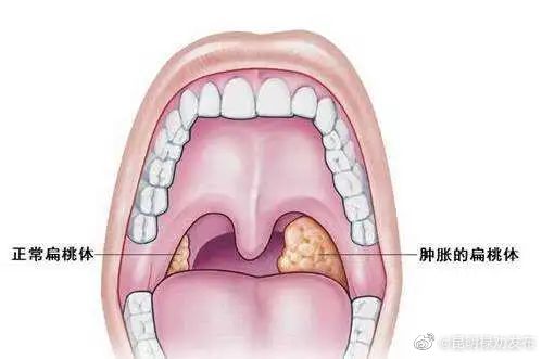 昆明禄劝发布