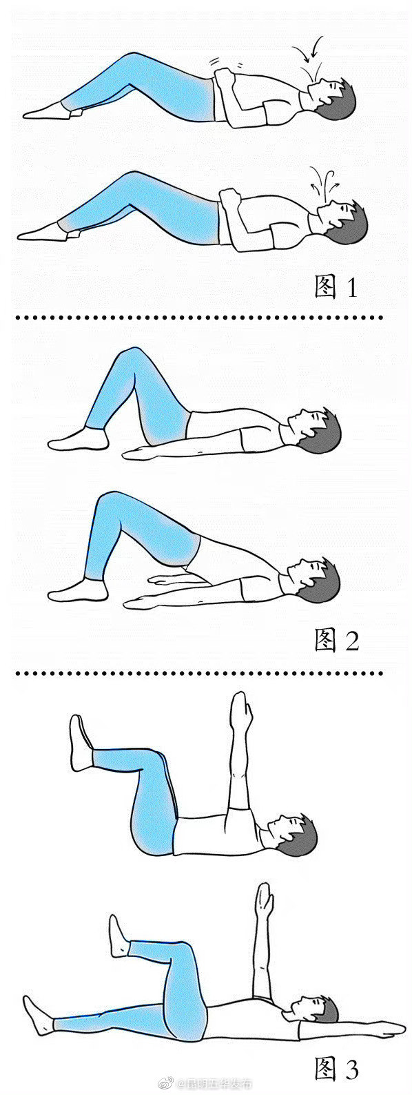 3个动作防脊柱侧弯
