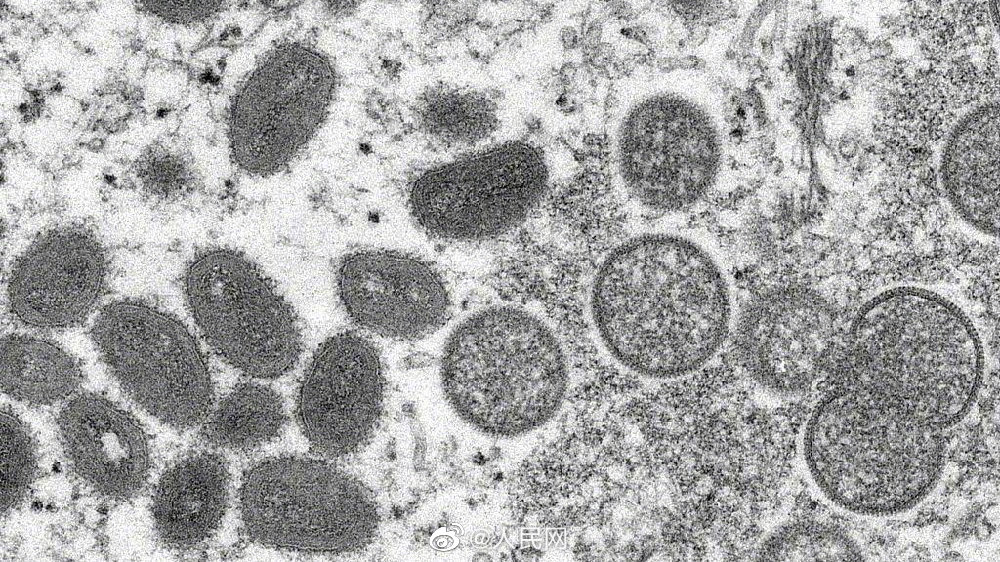 世卫称全球猴痘病例超1.8万例