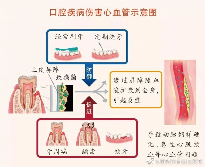 牙不好是如何伤害心血管的