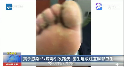 “昆明五华发布”微博