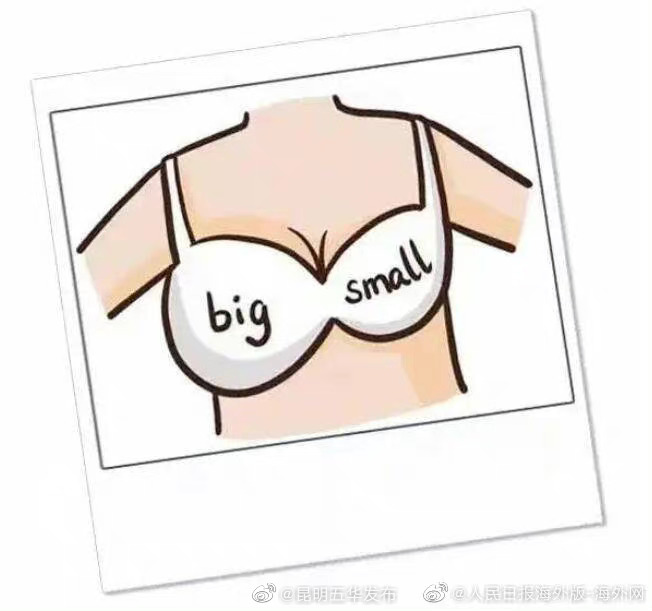 生命时报:乳房不对称一般来说是正常的 只有1种情况要警惕