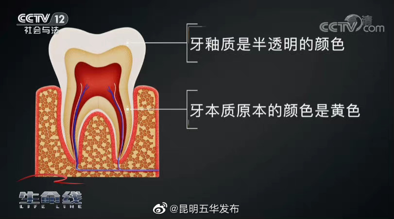 淡黄色才是牙齿的健康色号