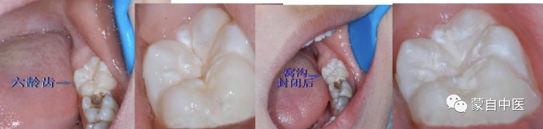 蒙自中医