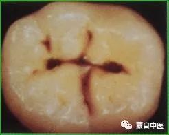蒙自中医