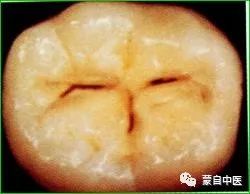蒙自中医