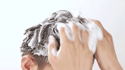 去屑洗发水别用太频繁，一周用一次即可