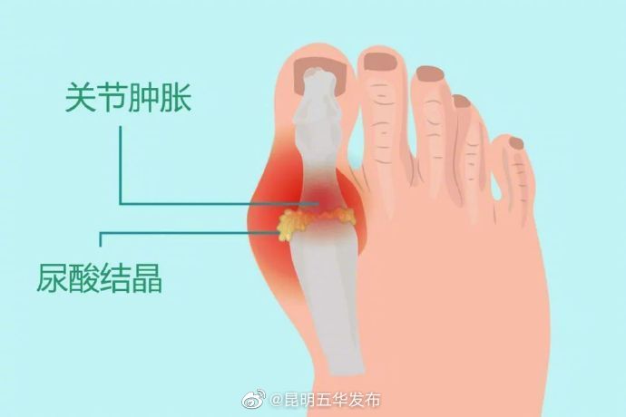 “昆明五华发布”微博