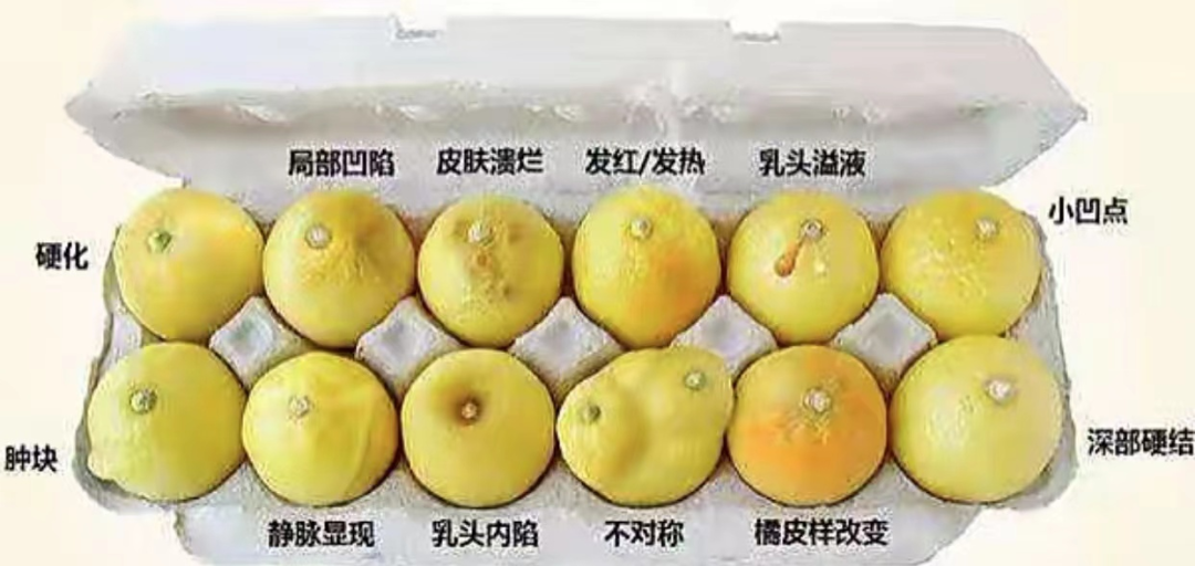 云南省文山州人民医院