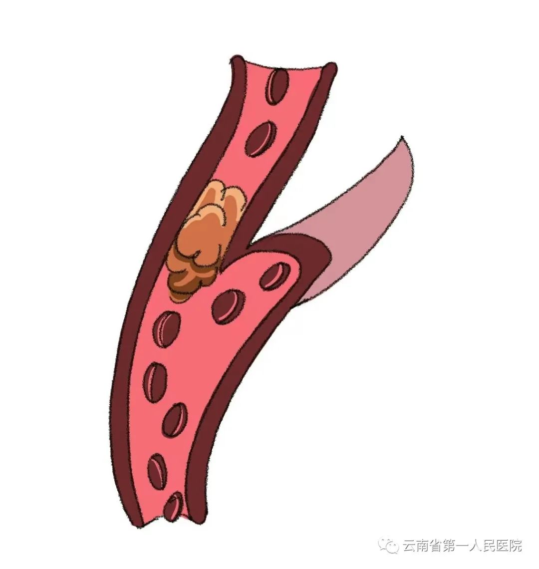 云南卫生12320