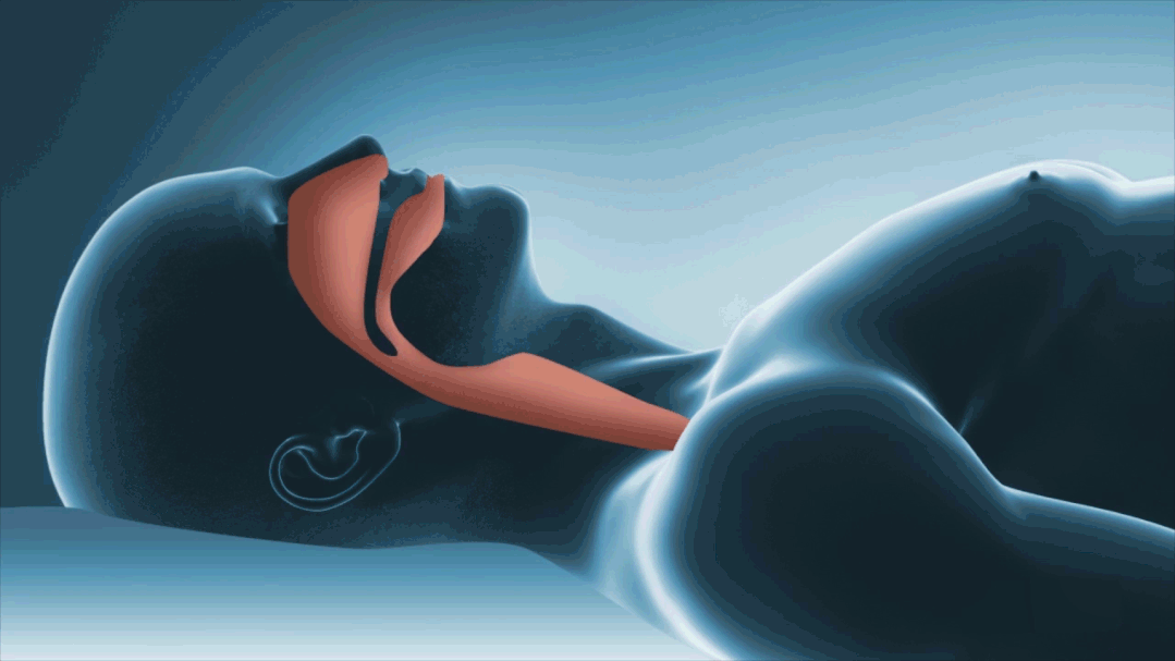 想当航天员不能打呼噜 