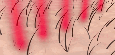 给脱发患者提个醒：怎么选择适合自己的生发药？