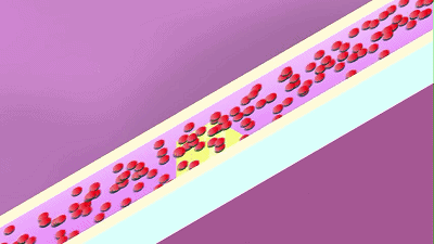 手脚冰凉伴6种症状要查血管