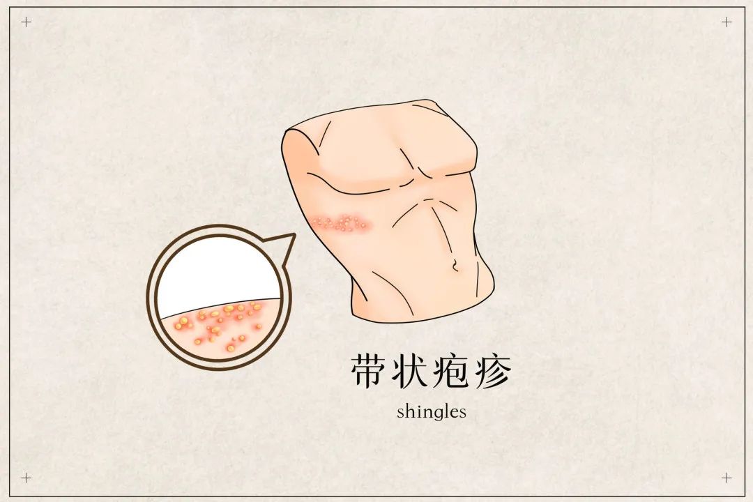 云南疾控