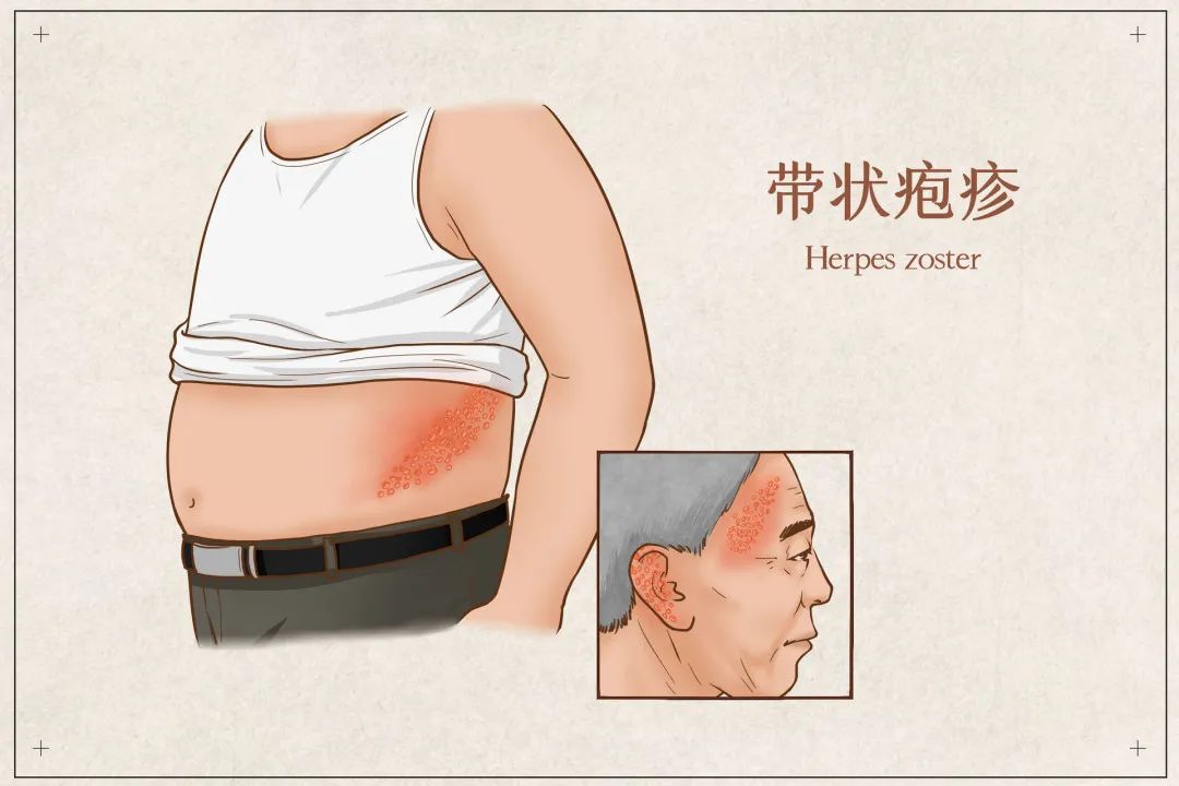 云南疾控