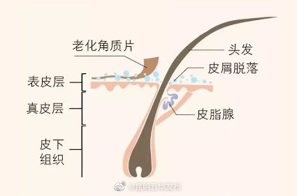 为什么你的头发比别人的爱出油?