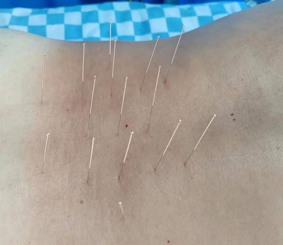 思茅区人民医院