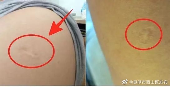 昆明市西山区发布