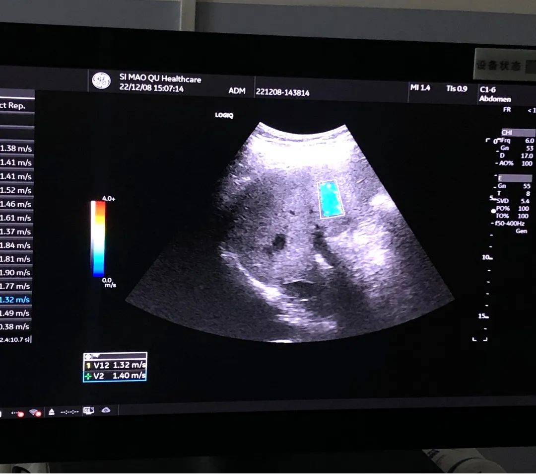 思茅区人民医院