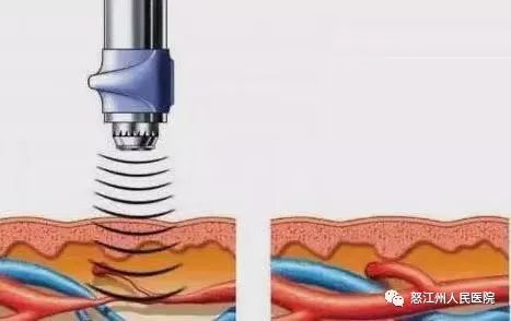 怒江州人民医院