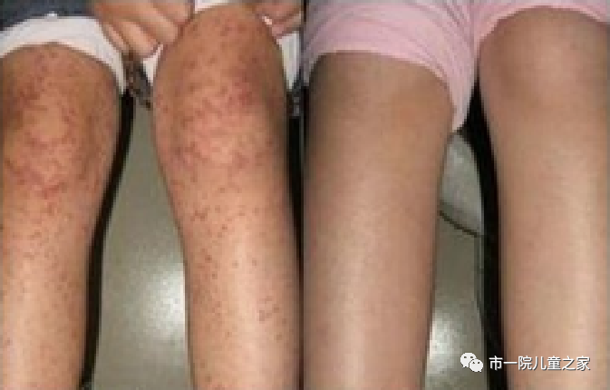 昆明市第一人民医院