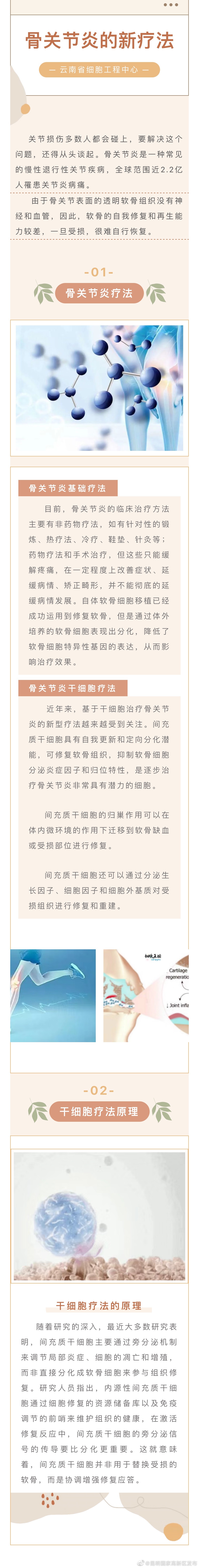 膝关节损伤，干细胞有招！