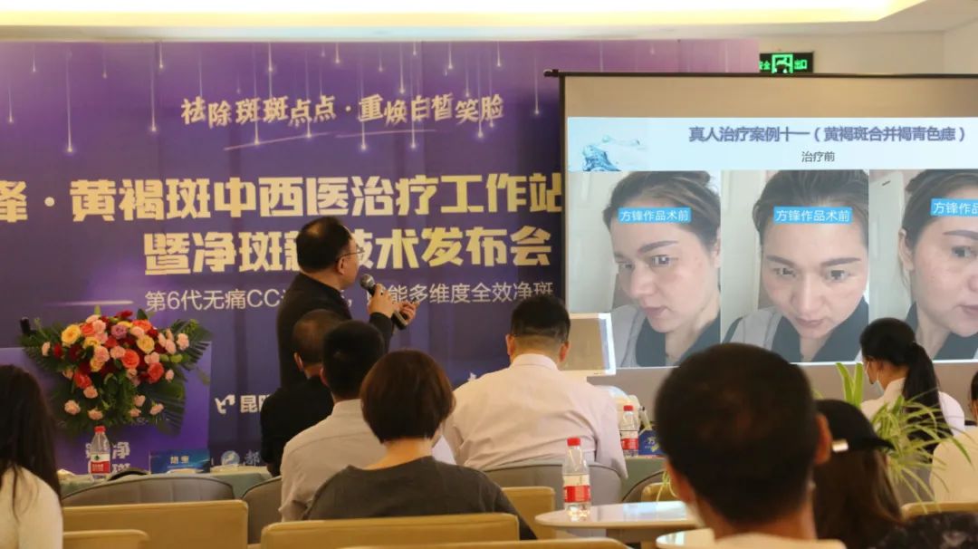 掌上春城