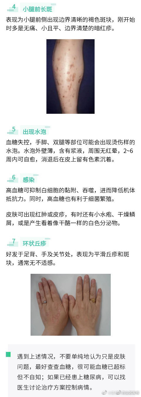 昆明市西山区发布