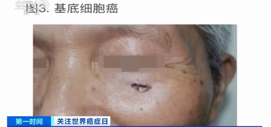 美丽云南微科普