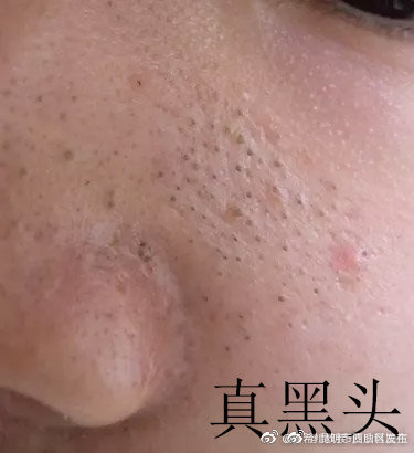 昆明市西山区发布