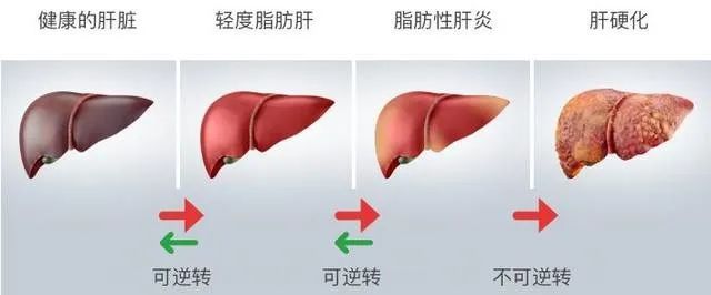 云南省传染病医院
