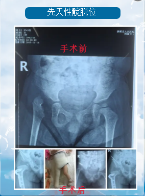 镇雄县人民医院