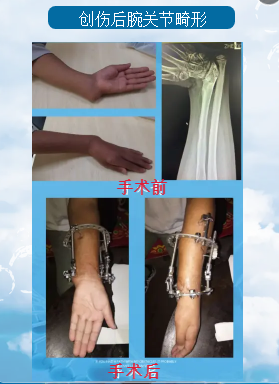 镇雄县人民医院
