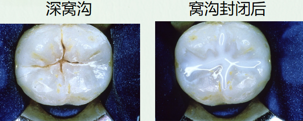 昆明医科大学附属口腔医院