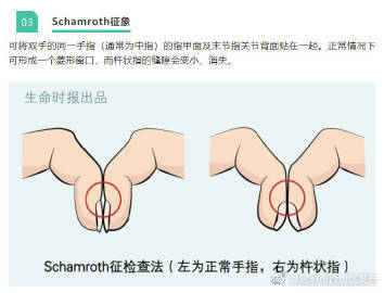 昆明市西山区发布