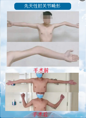 镇雄县人民医院
