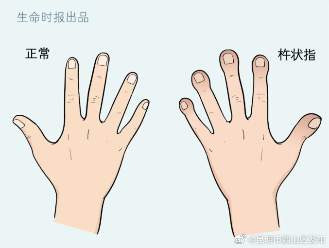 昆明市西山区发布