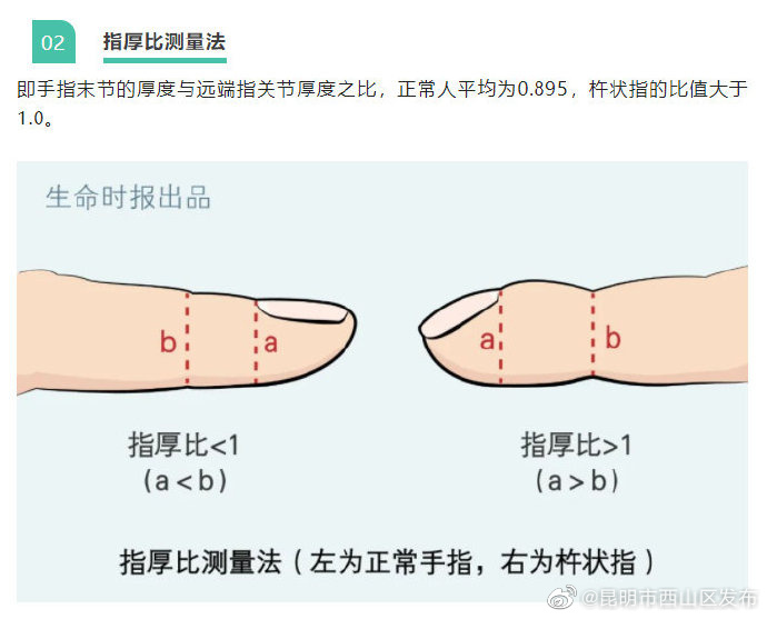 昆明市西山区发布