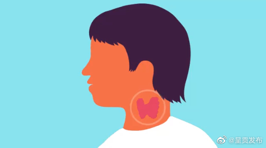 甲状腺结节需要治吗