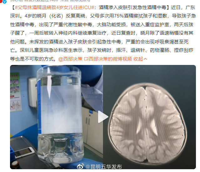 父母抹酒精退烧致4岁女儿住进ICU3种退烧法很危险