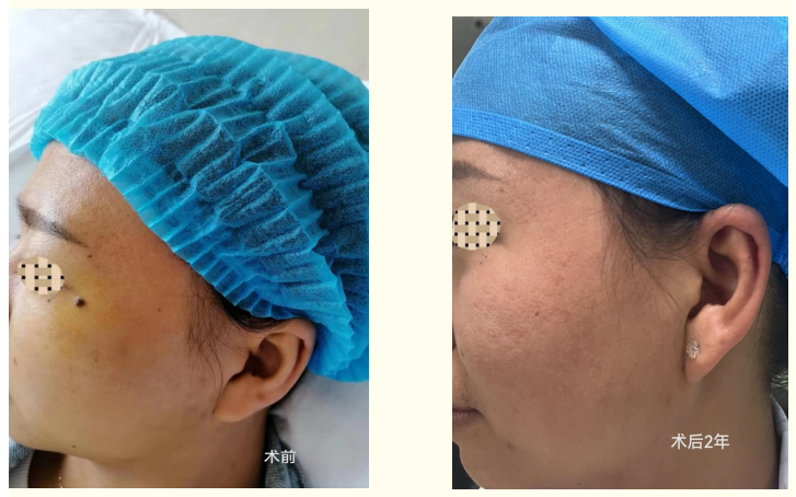 思茅区人民医院